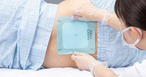 局所摩擦ずれ緩和シート〈TASS®Ⅱ〉発売のご案内｜商品｜アルケア株式会社