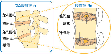 Mechanism of the intervertebral disks