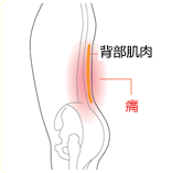 腰肌筋膜痛