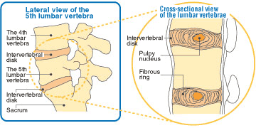 Mechanism of the intervertebral disks