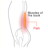 Backache is caused by a large variety of factors.