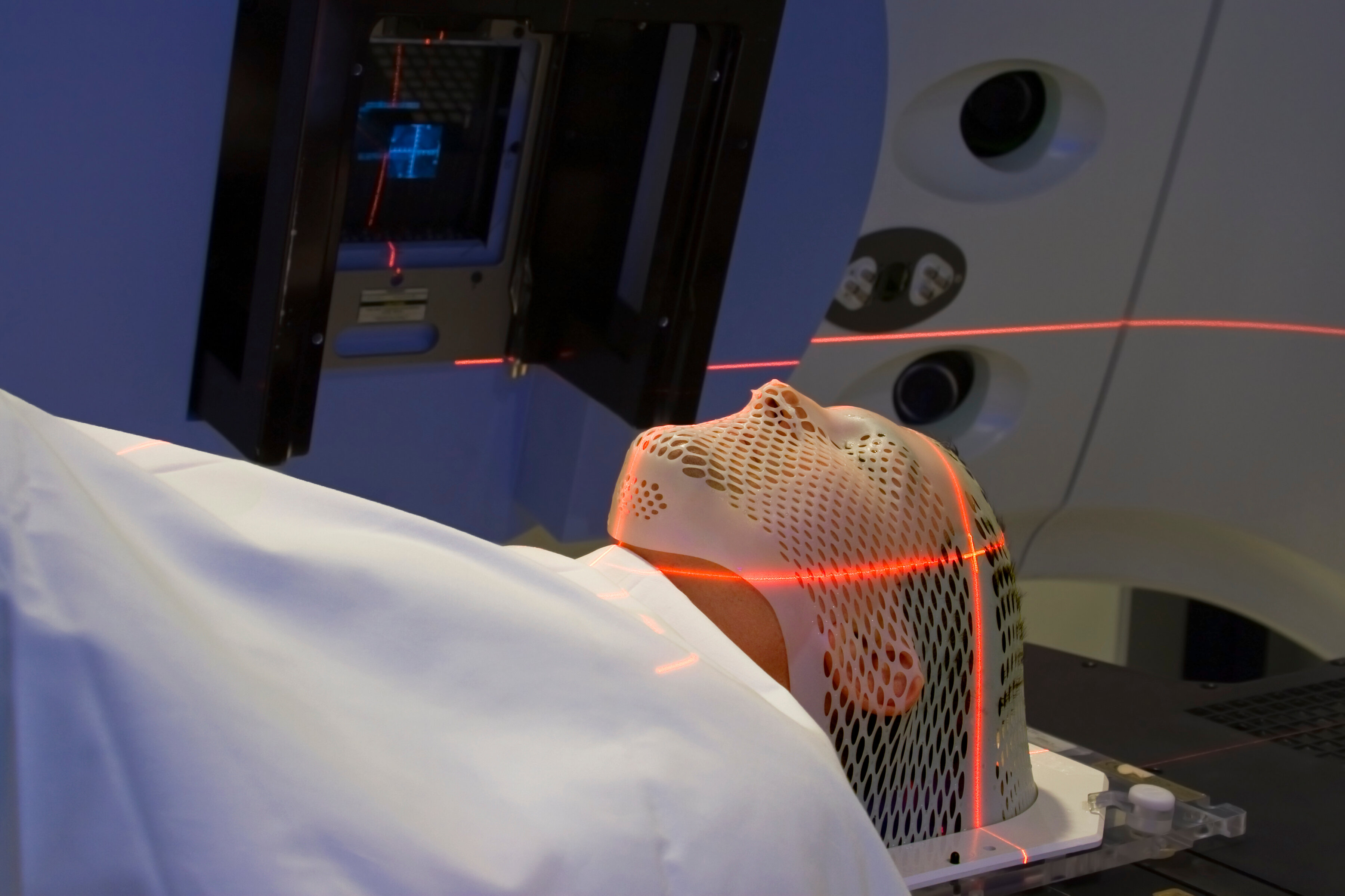 Using MOLDCARE Is Helpful For Precision And Reproducibility For Head 