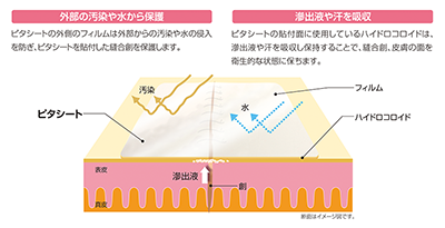 新商品発売のご案内《ピタシート》｜アルケア株式会社_03.png