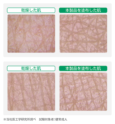 ラメラ構造セラミド配合による皮膚への効果