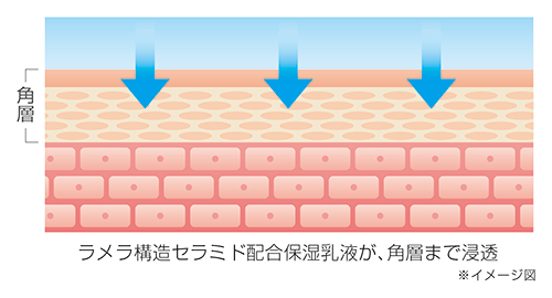 ラメラ構造2