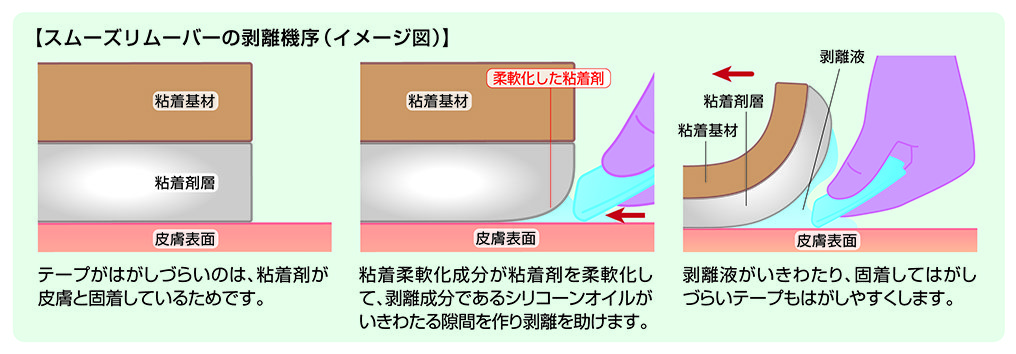 スムーズリムーバーの剥離機序（イメージ図）