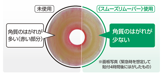 スムーズリムーバーと未使用時のはがした後の角質はがれ比較