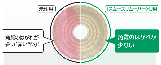 スムーズリムーバーと未使用時のはがした後の角質はがれ比較
