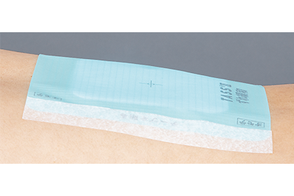 TASS®Ⅱ｜商品情報（医療関係者向け）