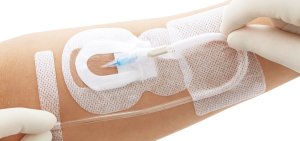 〈フィックスキット・PV〉_商品画像