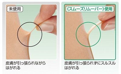 「スムーズリムーバーワイプシート」未使用の場合、皮膚が引っ張られながらはがれる　使用した場合、皮膚が引っ張られずにスルスルとはがれる
