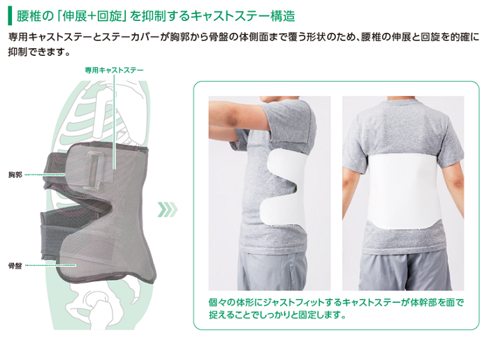 腰椎の伸展+回旋を抑制するキャストステー構造の画像。
