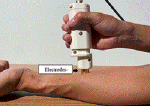 開発段階の皮膚測定機器を用いて皮膚を測定している様子.png