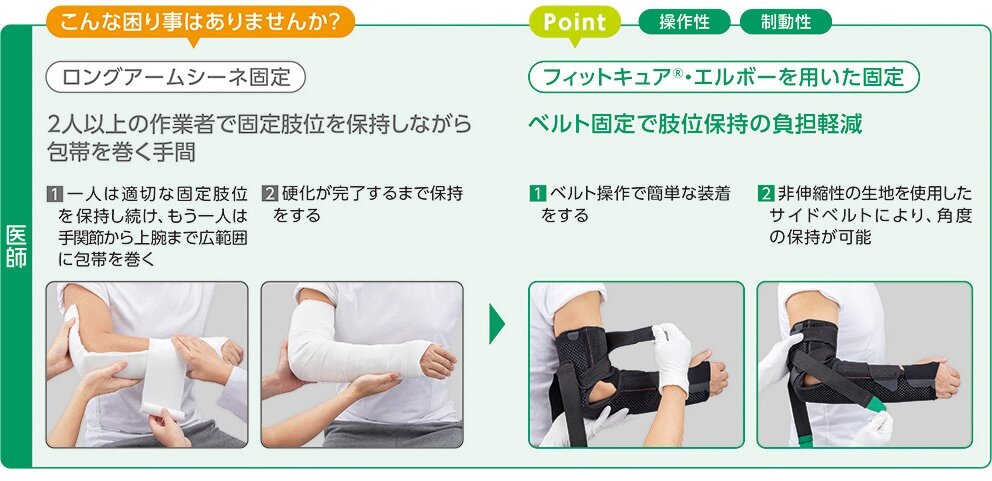 ベルト固定による肢位保持の負担軽減と装着再現性に関する説明