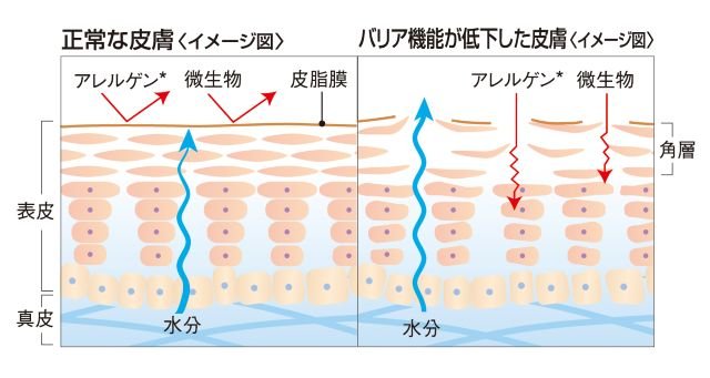 皮膚のバリア機能